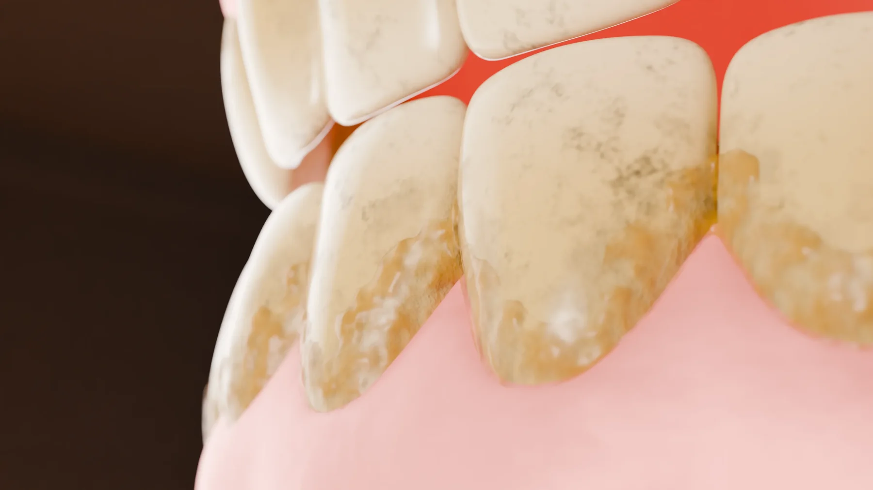 Teeth stain close-up